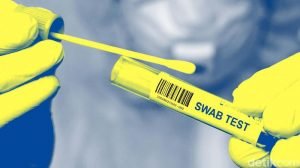 tes-swab_169